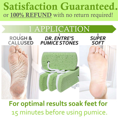 Dr. Entre's Pumice Stone for Feet 4 Pack with String to Hang Dry, Callus Remover Perfect for Shower Use