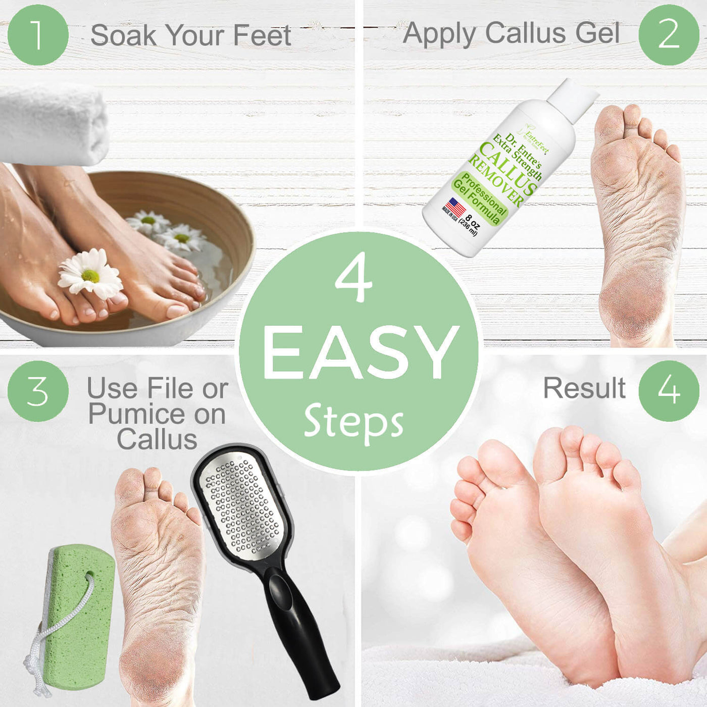 Dr. Entre's Callus Remover Kit: 8oz Callus Remover Gel, Foot File, Pumice Stone, 5 Glove Pairs for Gel Application, Spa Kit, Foot Care, Pedicure Tools